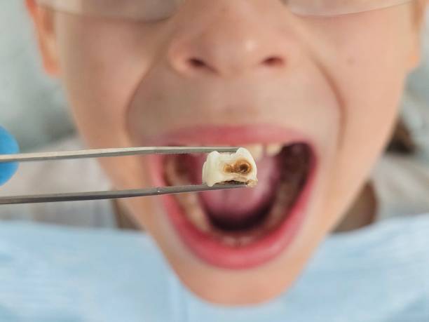 Best Walk-In Emergency Dental Services in Dover, AR